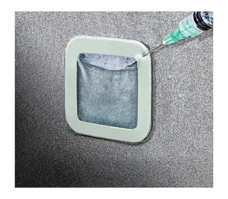 Adhesive Bresle Method Patch